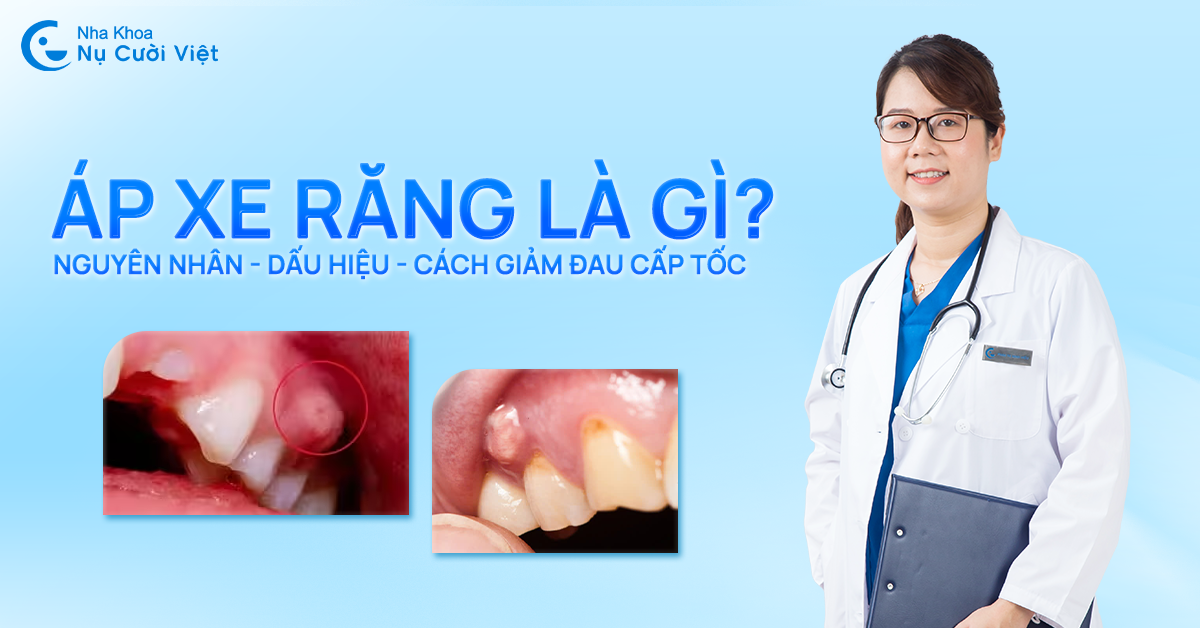 áp xe răng, nguyên nhân và giải pháp khắc phục