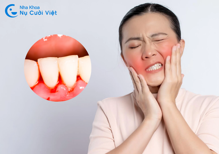 Nụ Cười Việt - Chảy máu chân răng: Dấu hiệu cảnh báo sức khỏe răng nướu gặp vấn đề