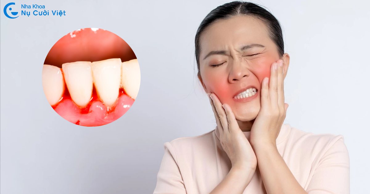 chảy máu chân răng là gì