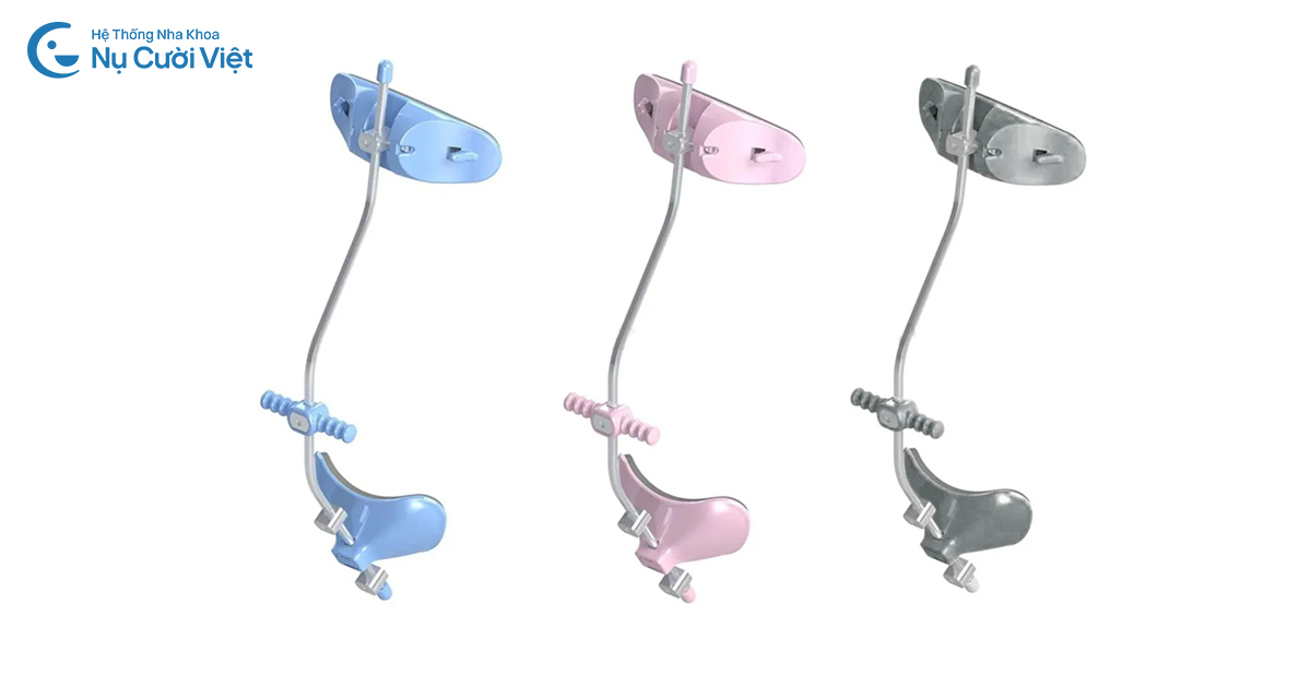 chỉnh móm bằng khí cụ chỉnh nha trẻ em