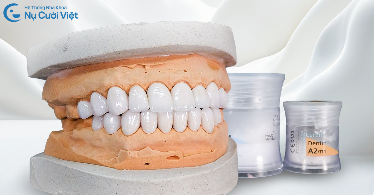 lưu ý khi làm răng sứ trước tết 