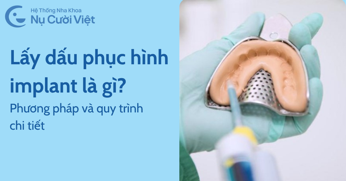 lấy dấu phục hình implant là gì