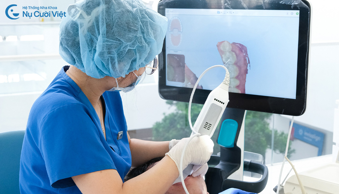 lấy dấu răng kỹ thuật số khi niềng răng