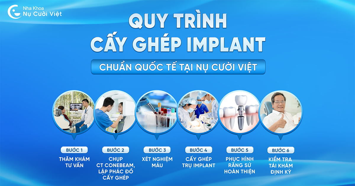 quy trình trồng răng implant mất răng số 6