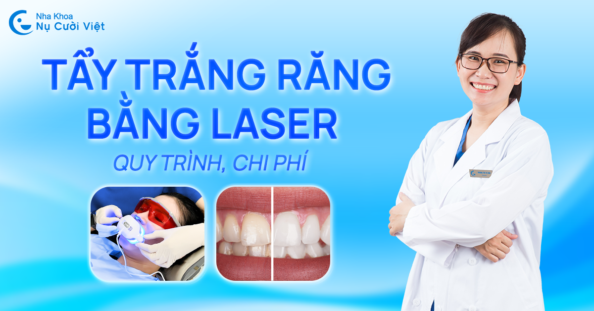 có nên tẩy trắng bằng đèn laser không