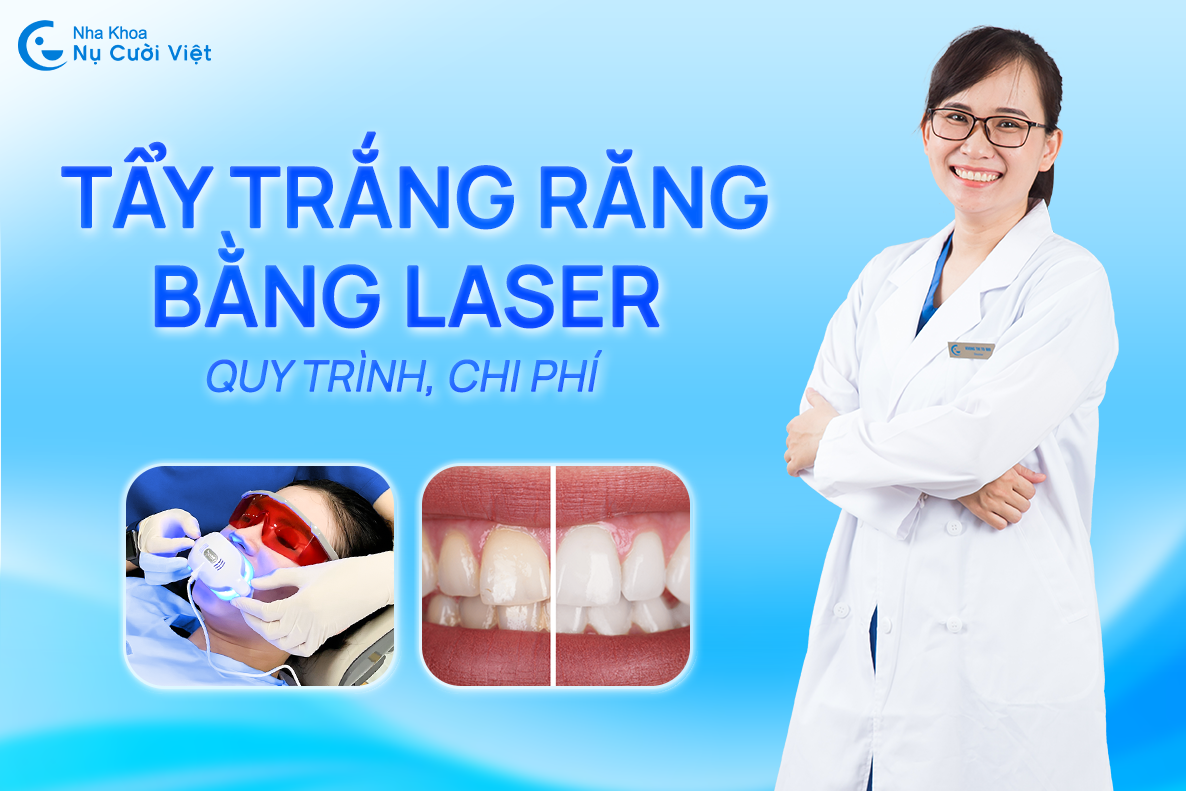 Nụ Cười Việt - Có nên tẩy trắng răng bằng Laser không? Quy trình, chi phí như thế nào?