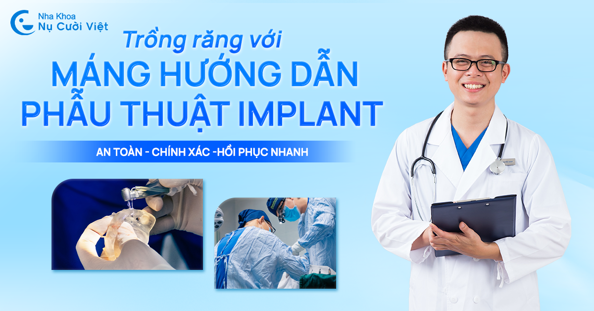 trồng răng implant bằng máng hướng dẫn phẫu thuật
