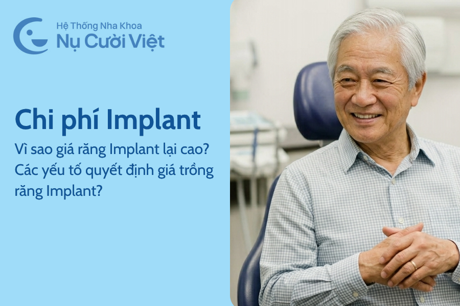 Nụ Cười Việt - Vì sao giá của răng Implant lại cao? Các yếu tố quyết định giá trồng răng Implant