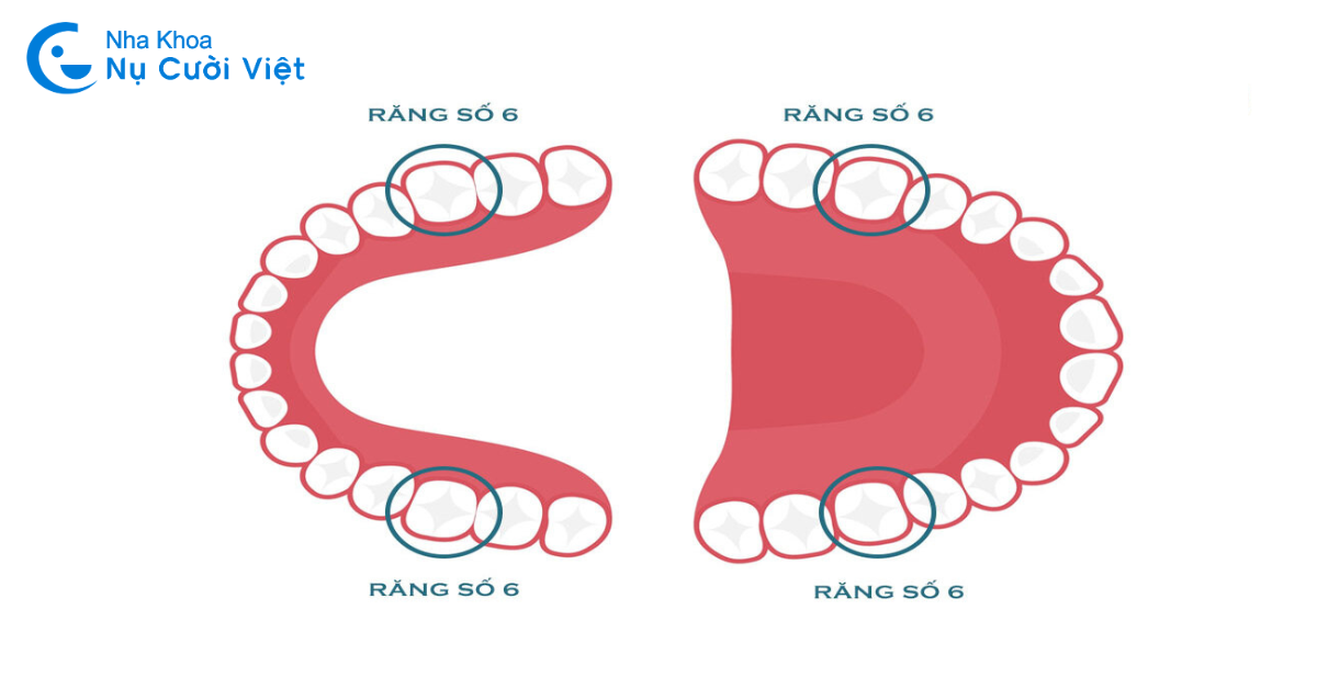 răng số 6 là gì, vị trí răng số 6