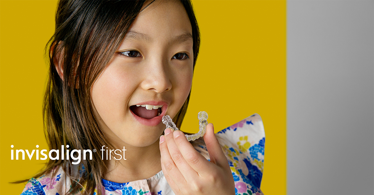 yếu tố ảnh hưởng thời gian niềng răng